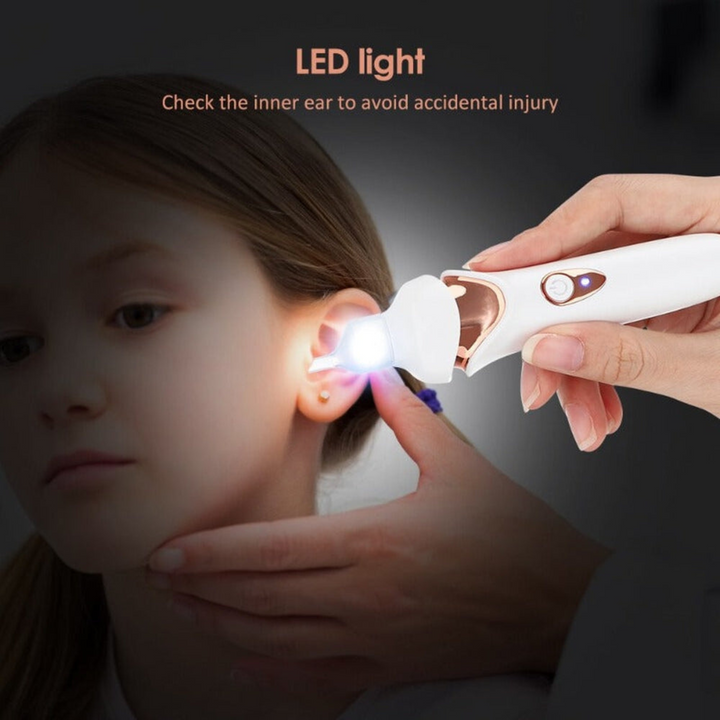 Osaya | Pijnloze Oorsmeerzuiger | Ingebouwde LED Verlichting