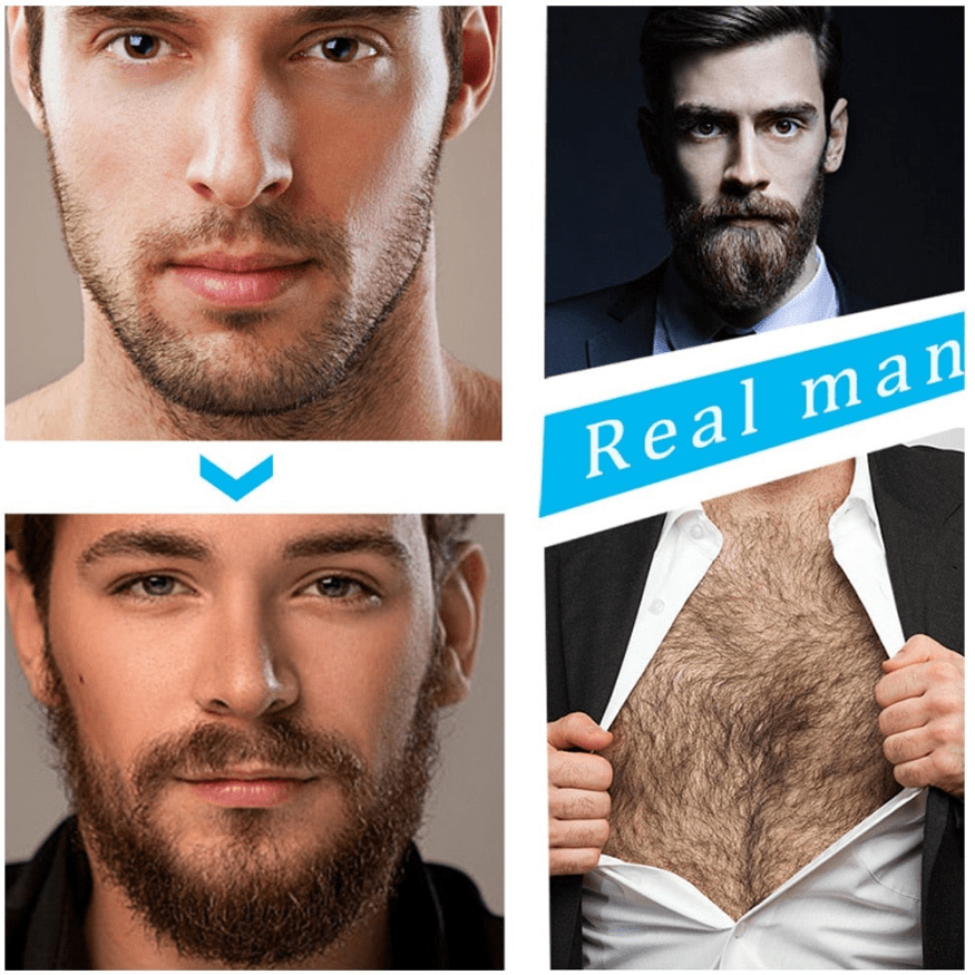 Manly | Baard Verzorging | Professionele Baard Groei Kit - Sorata